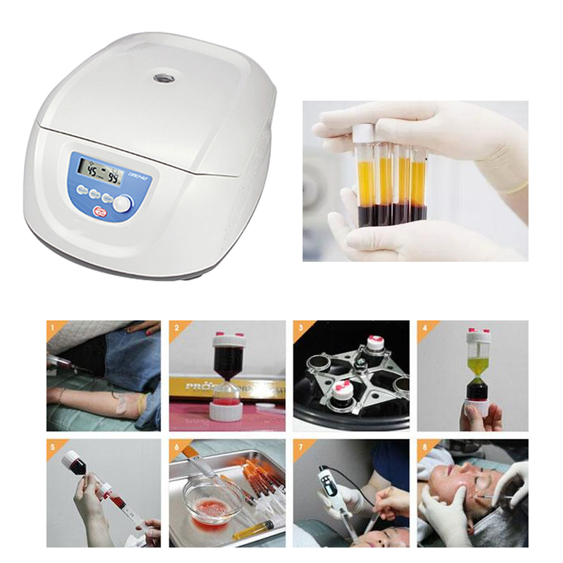 Mesin Centrifuge Medis PRP PRF - Medical Lab Center ulasan dan harga